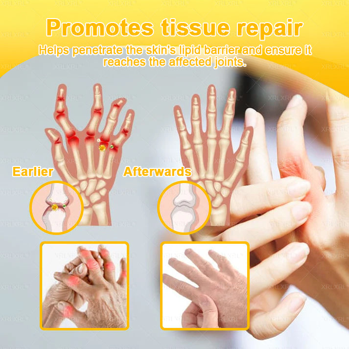 XRLXRL® Bee-Venom Pain-Relief Bone Healing Cream 👑👑(Specially for older adults)