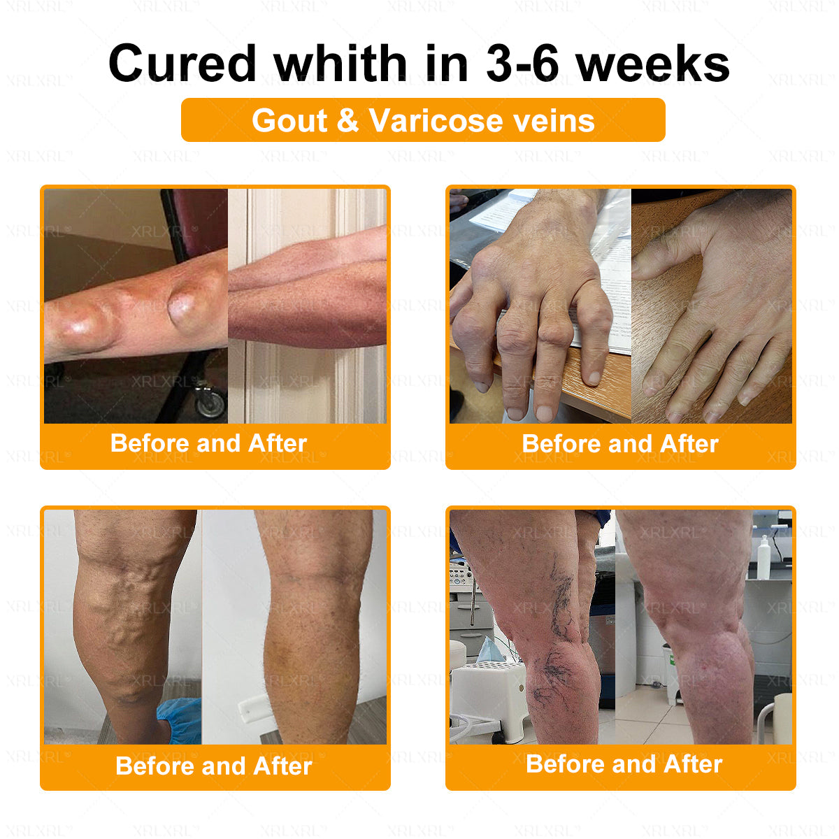 XRLXRL® Bee-Venom Pain-Relief Bone Healing Cream 👑👑(Specially for older adults)
