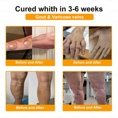 XRLXRL® Bee-Venom Pain-Relief Bone Healing Cream 👑👑(Specially for older adults)