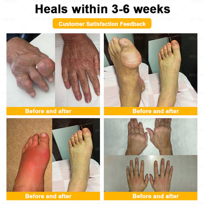 XRLXRL® Bee-Venom Pain-Relief Bone Healing Cream 👑👑(Specially for older adults)