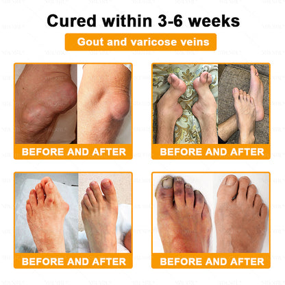 XRLXRL® Bee-Venom Pain-Relief Bone Healing Cream 👑👑(Specially for older adults)