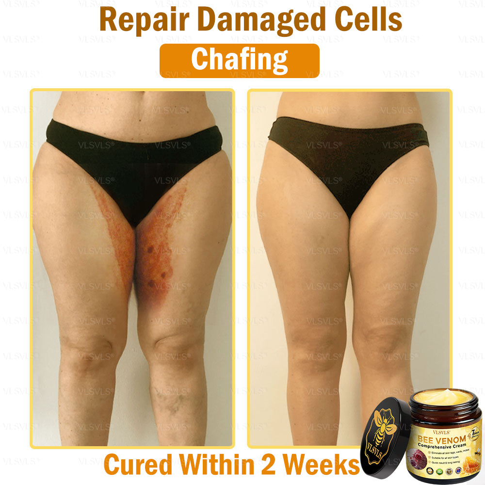 VLSVLS®🎁🎁🎁One last chance! Grab this lucky find at 70% OFF!