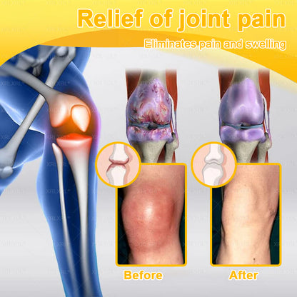 XRLXRL® Bee-Venom Pain-Relief Bone Healing Cream 👑👑(Specially for older adults)